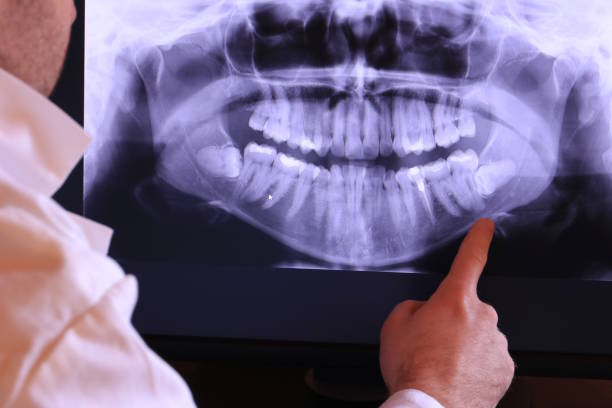 Best After-Hours Emergency Dentist in Morse, LA