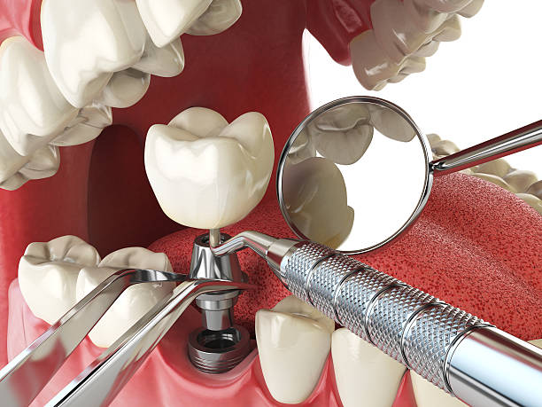 Best Pediatric Emergency Dentist in Morse, LA
